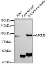 MCM5 Antibody in Immunoprecipitation (IP)