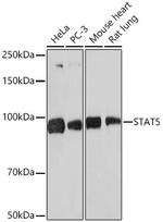 STAT5 alpha/beta Antibody in Western Blot (WB)