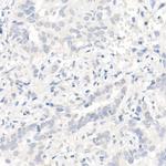 EGFR Antibody in Immunohistochemistry (Paraffin) (IHC (P))