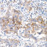 EGFR Antibody in Immunohistochemistry (Paraffin) (IHC (P))