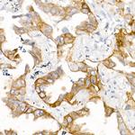 EGFR Antibody in Immunohistochemistry (Paraffin) (IHC (P))