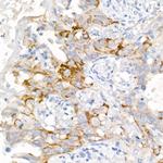 EGFR Antibody in Immunohistochemistry (Paraffin) (IHC (P))