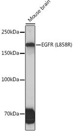 EGFR Antibody in Western Blot (WB)