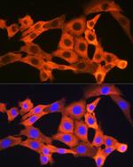 JNK1/JNK3 Antibody in Immunocytochemistry (ICC/IF)