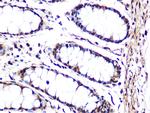 JNK1/JNK3 Antibody in Immunohistochemistry (Paraffin) (IHC (P))