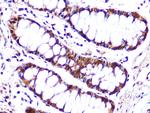 Cullin 4A Antibody in Immunohistochemistry (Paraffin) (IHC (P))