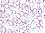 ATP1B1 Antibody in Immunohistochemistry (Paraffin) (IHC (P))