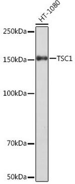 TSC1 Antibody in Western Blot (WB)