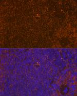 WASP Antibody in Immunohistochemistry (Paraffin) (IHC (P))