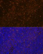 WASP Antibody in Immunohistochemistry (Paraffin) (IHC (P))