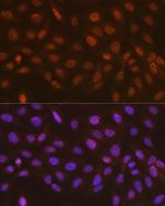 RAD23A Antibody in Immunocytochemistry (ICC/IF)