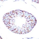 CHRM2 Antibody in Immunohistochemistry (Paraffin) (IHC (P))