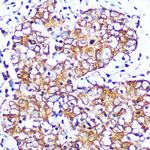 CHRM2 Antibody in Immunohistochemistry (Paraffin) (IHC (P))