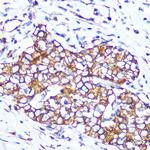 Pannexin 1 Antibody in Immunohistochemistry (Paraffin) (IHC (P))