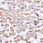 GluD1 Antibody in Immunohistochemistry (Paraffin) (IHC (P))