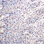 GluD1 Antibody in Immunohistochemistry (Paraffin) (IHC (P))