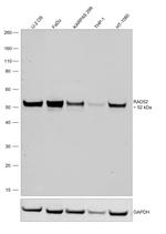 RAD52 Antibody in Western Blot (WB)