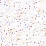 DP1 Antibody in Immunohistochemistry (Paraffin) (IHC (P))