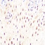 DP1 Antibody in Immunohistochemistry (Paraffin) (IHC (P))