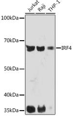 IRF4 Antibody in Western Blot (WB)