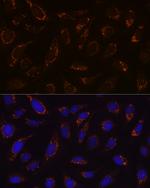 DLD Antibody in Immunocytochemistry (ICC/IF)