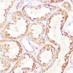 DLD Antibody in Immunohistochemistry (Paraffin) (IHC (P))