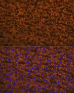 ANGPTL3 Antibody in Immunohistochemistry (Paraffin) (IHC (P))