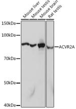 ACVR2A Antibody in Western Blot (WB)