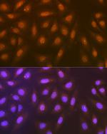 Syntenin 1 Antibody in Immunocytochemistry (ICC/IF)