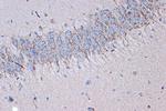 Syntenin 1 Antibody in Immunohistochemistry (Paraffin) (IHC (P))