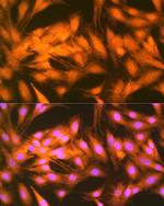 FGF1 Antibody in Immunocytochemistry (ICC/IF)