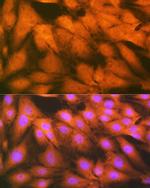 HSPA2 Antibody in Immunocytochemistry (ICC/IF)