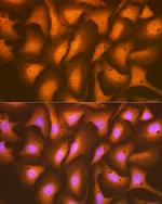 HSPA2 Antibody in Immunocytochemistry (ICC/IF)