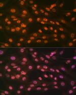 JMJD2B Antibody in Immunocytochemistry (ICC/IF)