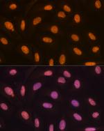 JMJD2B Antibody in Immunocytochemistry (ICC/IF)