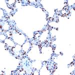 ADAM15 Antibody in Immunohistochemistry (Paraffin) (IHC (P))