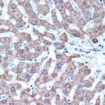 ADAM15 Antibody in Immunohistochemistry (Paraffin) (IHC (P))