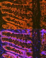 ADAM15 Antibody in Immunohistochemistry (Paraffin) (IHC (P))