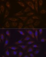 DCP1A Antibody in Immunocytochemistry (ICC/IF)