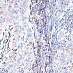 DCP1A Antibody in Immunohistochemistry (Paraffin) (IHC (P))