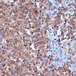 PKC delta Antibody in Immunohistochemistry (Paraffin) (IHC (P))