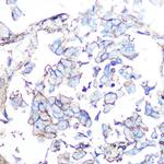 SSTR5 Antibody in Immunohistochemistry (Paraffin) (IHC (P))