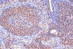 MSH2 Antibody in Immunohistochemistry (Paraffin) (IHC (P))