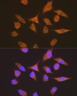 EEF1G Antibody in Immunocytochemistry (ICC/IF)