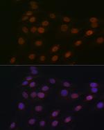 RANGAP1 Antibody in Immunocytochemistry (ICC/IF)