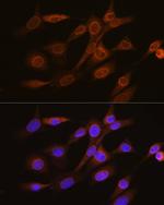 RANGAP1 Antibody in Immunocytochemistry (ICC/IF)