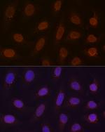 RANGAP1 Antibody in Immunocytochemistry (ICC/IF)