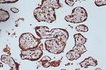 RANGAP1 Antibody in Immunohistochemistry (Paraffin) (IHC (P))