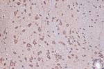 RANGAP1 Antibody in Immunohistochemistry (Paraffin) (IHC (P))