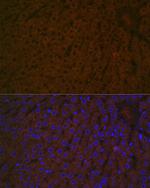 Haptoglobin Antibody in Immunohistochemistry (Paraffin) (IHC (P))